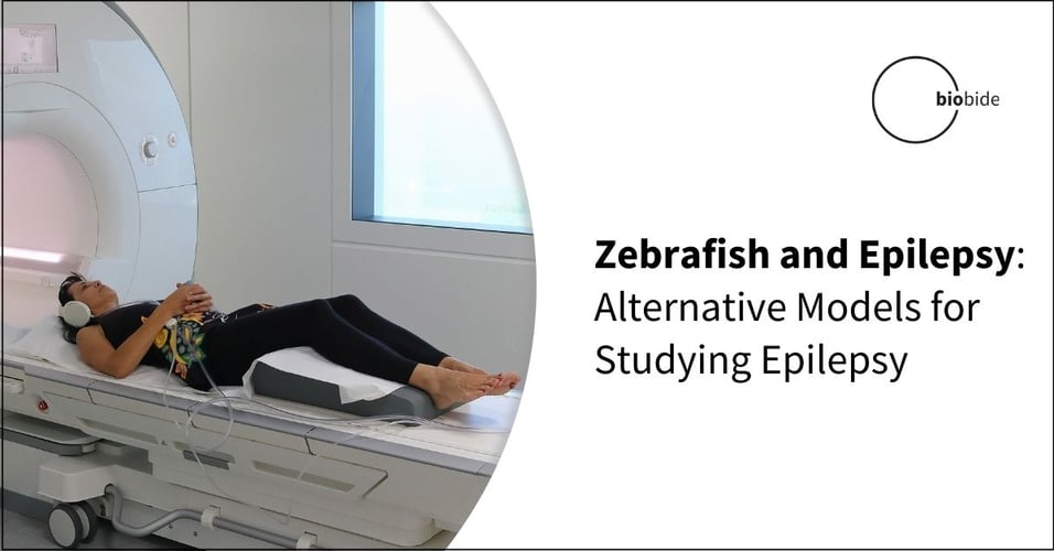 Zebrafish and Epilepsy: Alternative Models for Studying Epilepsy