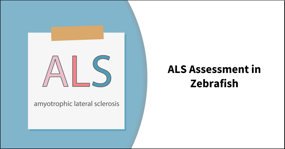 The Mobility issues associated with Amyotrophic Lateral Sclerosis